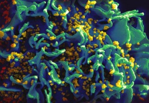 SEM: Scanning electron microscopy of HIV particles infecting body's T cell. (Credit: NIH/National Institute of Allergy and Infectious Diseases)