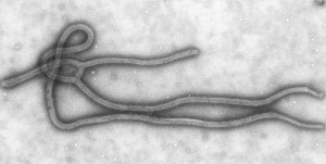 Ebola virus image