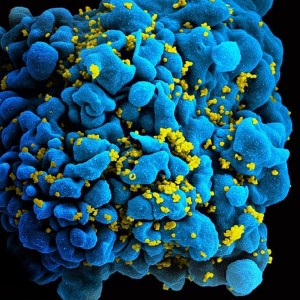 hiv virus image